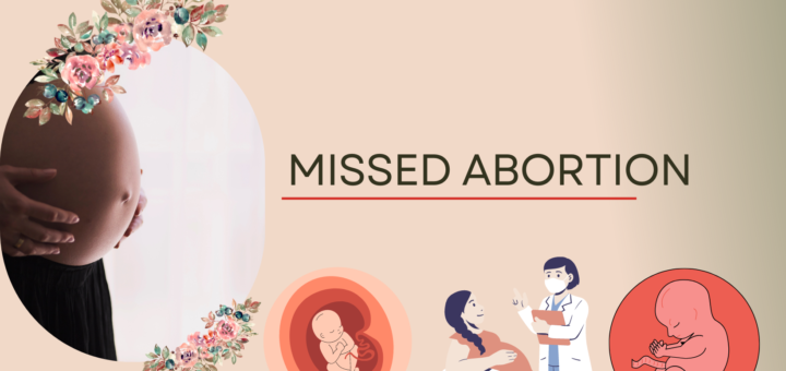 missed abortion