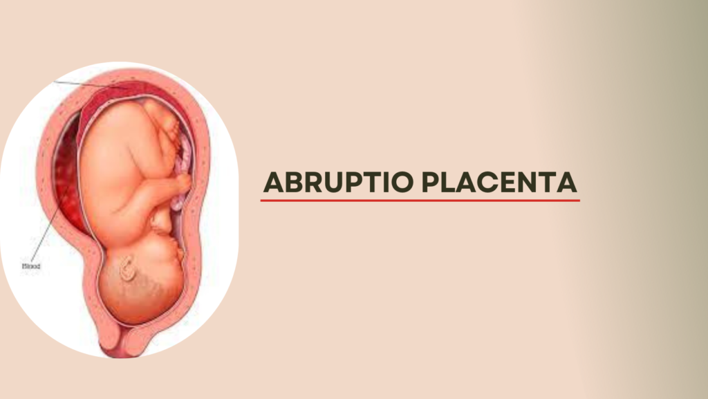 Abruptio Placenta.