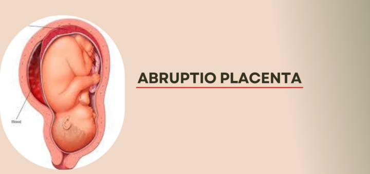 Abruptio Placenta.