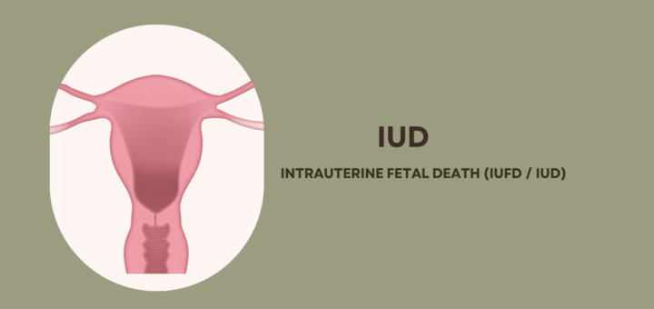 of Intrauterine Fetal death (IUFD / IUD)