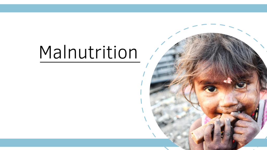 Malnutrition