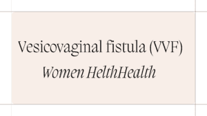 Vesicovaginal fistula (VVF)