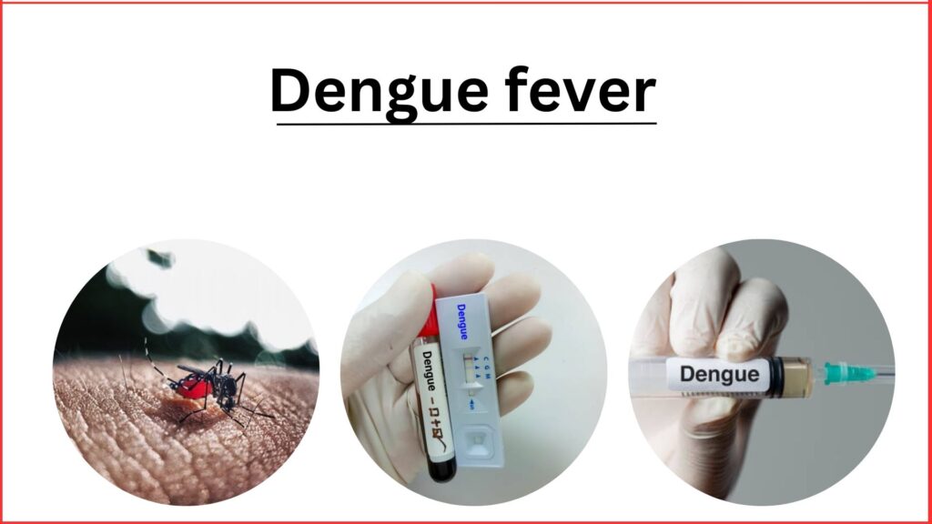 Dengue fever