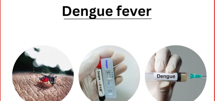 Dengue fever