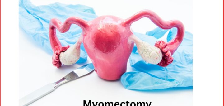 Myomectomy