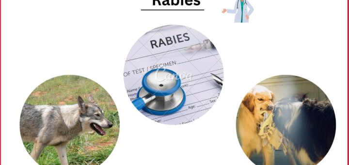 Rabies