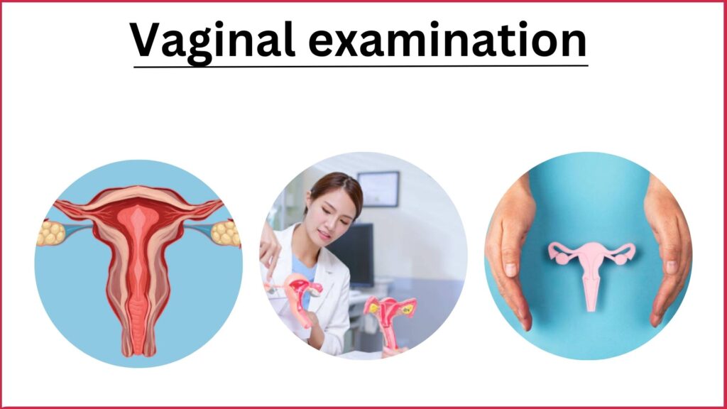 Vaginal examination