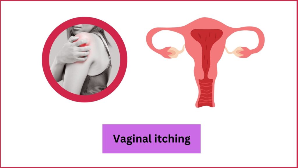 Vaginal itching