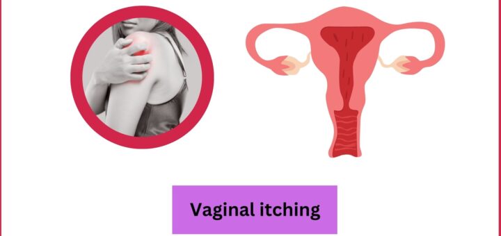 Vaginal itching