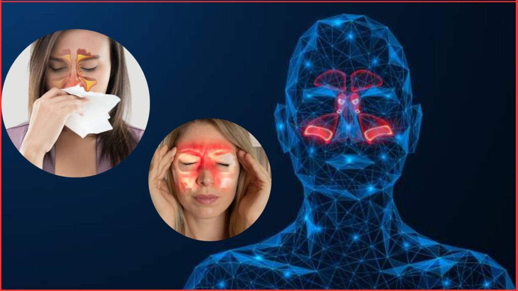 Atrophic rhinitis