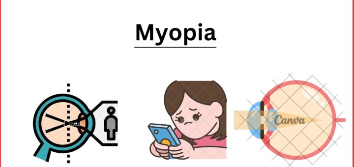 Myopia